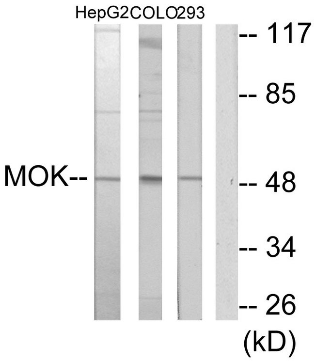 MOK / RAGE Antibody - Western blot analysis of lysates from HepG2, COLO205, and 293 cells, using MOK Antibody. The lane on the right is blocked with the synthesized peptide.