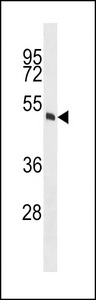 MOK / RAGE Antibody - MOK Antibody (S392) western blot of A549 cell line lysates (35 ug/lane). The MOK antibody detected the MOK protein (arrow).