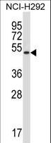 MOK / RAGE Antibody - Mouse Rage Antibody western blot of NCI-H292 cell line lysates (35 ug/lane). The Rage antibody detected the Rage protein (arrow).