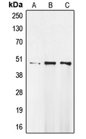 MOK / RAGE Antibody - Western blot analysis of MOK expression in Raji (A); MDAMB231 (B); A549 (C) whole cell lysates.