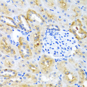 MOK / RAGE Antibody - Immunohistochemistry of paraffin-embedded mouse kidney using MOK antibodyat dilution of 1:100 (40x lens).