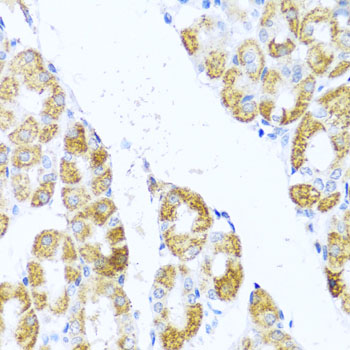 MOK / RAGE Antibody - Immunohistochemistry of paraffin-embedded human stomach using MOK antibodyat dilution of 1:100 (40x lens).