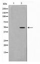 MOK / RAGE Antibody - Western blot of HepG2 cell lysate using MOK Antibody