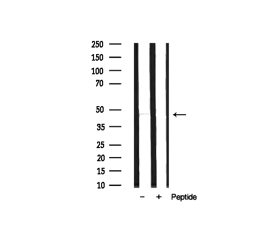 MOK / RAGE Antibody - Western blot analysis on rat brain lysate using MOK antibody