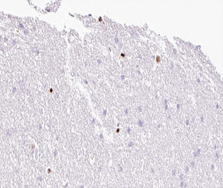 MOK / RAGE Antibody - 1:100 staining human brain tissue by IHC-P. The tissue was formaldehyde fixed and a heat mediated antigen retrieval step in citrate buffer was performed. The tissue was then blocked and incubated with the antibody for 1.5 hours at 22°C. An HRP conjugated goat anti-rabbit antibody was used as the secondary.