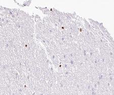 MOK / RAGE Antibody - 1:100 staining human brain tissue by IHC-P. The tissue was formaldehyde fixed and a heat mediated antigen retrieval step in citrate buffer was performed. The tissue was then blocked and incubated with the antibody for 1.5 hours at 22°C. An HRP conjugated goat anti-rabbit antibody was used as the secondary.