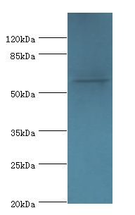 MON1A / SAND1 Antibody - Western blot. All lanes: Vacuolar fusion protein MON1 homolog A antibody at 2 ug/ml+U251 whole cell lysate. Secondary antibody: Goat polyclonal to rabbit at 1:10000 dilution. Predicted band size: 62 kDa. Observed band size: 62 kDa.  This image was taken for the unconjugated form of this product. Other forms have not been tested.