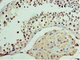MON1A / SAND1 Antibody - Immunohistochemistry of paraffin-embedded human testis tissue using antibody at 1:100 dilution.  This image was taken for the unconjugated form of this product. Other forms have not been tested.