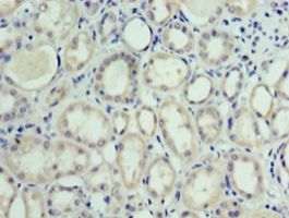 MON1A / SAND1 Antibody - Immunohistochemistry of paraffin-embedded human kidney tissue using antibody at 1:100 dilution.  This image was taken for the unconjugated form of this product. Other forms have not been tested.