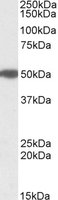 MON1A / SAND1 Antibody - MON1A antibody (1 ug/ml) staining of Human Pancreas lysate (35 ug protein/ml in RIPA buffer). Primary incubation was 1 hour. Detected by chemiluminescence.