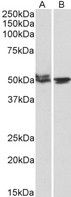 MON1A / SAND1 Antibody - Goat Anti-MON1A (aa478-489) Antibody (1µg/ml) staining of Mouse (A) and Rat (B) Testis lysates (35µg protein in RIPA buffer). Primary incubation was 1 hour. Detected by chemiluminescencence.