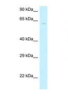 MON1B Antibody - MON1B antibody Western blot of HeLa Cell lysate. Antibody concentration 1 ug/ml.  This image was taken for the unconjugated form of this product. Other forms have not been tested.