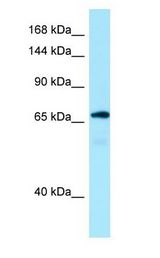 MON2 Antibody - MON2 antibody Western Blot of Fetal Kidney.  This image was taken for the unconjugated form of this product. Other forms have not been tested.