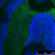 mOrange Antibody - Immunohistochemical staining of Frozen section Brain tissue from hGFAP-Cre, Rosa26 TdTomato mice using anti-mOrange mouse monoclonal antibody. (1:100). Secondary antibody: Alexa 488 goat anti-mouse.