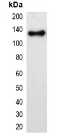 mOrange Tag Antibody - Western blot analysis of over-expressed mOrange-tagged protein in 293T cell lysate.