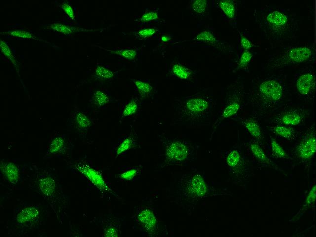 MORC1 Antibody - Immunofluorescence staining of MORC1 in Hela cells. Cells were fixed with 4% PFA, permeabilzed with 0.1% Triton X-100 in PBS, blocked with 10% serum, and incubated with rabbit anti-Human MORC1 polyclonal antibody (dilution ratio 1:200) at 4°C overnight. Then cells were stained with the Alexa Fluor 488-conjugated Goat Anti-rabbit IgG secondary antibody (green). Positive staining was localized to Nucleus.