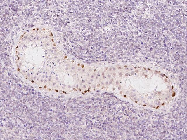 MORC1 Antibody - Immunochemical staining of human MORC1 in human testis with rabbit polyclonal antibody at 1:1000 dilution, formalin-fixed paraffin embedded sections.