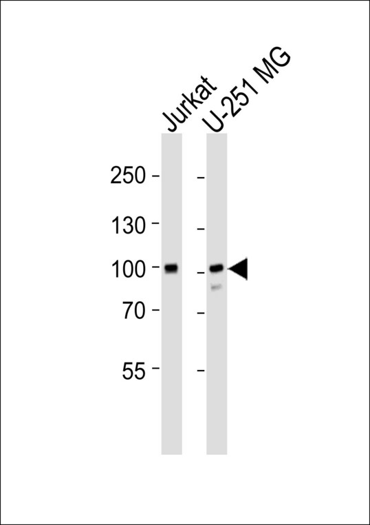 MORC2 Antibody - Western blot of lysates from Jurkat, U-251 MG cell line (from left to right) with MORC2 Antibody. Antibody was diluted at 1:1000 at each lane. A goat anti-rabbit IgG H&L (HRP) at 1:5000 dilution was used as the secondary antibody. Lysates at 35 ug per lane.