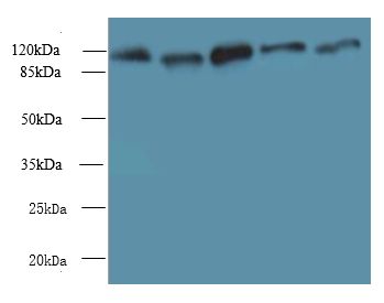 MORC2 Antibody - Western blot. All lanes: MORC2 antibody at 6 ug/ml. Lane 1: U87 whole cell lysate. Lane 2: U251 whole cell lysate. Lane 3: Jurkat whole cell lysate. Lane 4: HeLa whole cell lysate. Lane 5: MCF7 whole cell lysate. Secondary Goat polyclonal to Rabbit IgG at 1:10000 dilution. Predicted band size: 118 kDa. Observed band size: 118 kDa.
