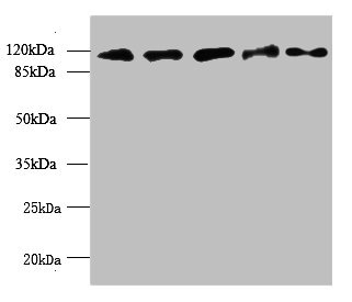 MORC2 Antibody - Western blot All lanes: MORC2 antibody at 6µg/ml Lane 1: U87 whole cell lysate Lane 2: U251 whole cell lysate Lane 3: Jurkat whole cell lysate Lane 4: Hela whole cell lysate Lane 5: MCF-7 whole cell lysate Secondary Goat polyclonal to rabbit IgG at 1/10000 dilution Predicted band size: 118, 111 kDa Observed band size: 118 kDa