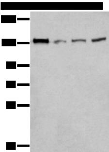 MORC2 Antibody - Western blot analysis of 293T Hela and A172 cell lysates  using MORC2 Polyclonal Antibody at dilution of 1:300