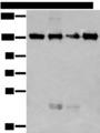 MORC2 Antibody - Western blot analysis of 293T and 231 cell lysates  using MORC2 Polyclonal Antibody at dilution of 1:250