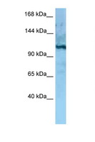 MORC4 Antibody - MORC4 antibody Western blot of Rat Liver lysate. Antibody concentration 1 ug/ml.  This image was taken for the unconjugated form of this product. Other forms have not been tested.