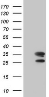 MORF4 Antibody - HEK293T cells were transfected with the pCMV6-ENTRY control (Left lane) or pCMV6-ENTRY MORF4 (Right lane) cDNA for 48 hrs and lysed. Equivalent amounts of cell lysates (5 ug per lane) were separated by SDS-PAGE and immunoblotted with anti-MORF4.