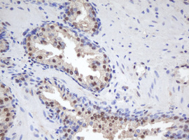 MORF4 Antibody - IHC of paraffin-embedded Human prostate tissue using anti-MORF4 mouse monoclonal antibody.