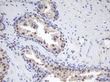 MORF4 Antibody - IHC of paraffin-embedded Human prostate tissue using anti-MORF4 mouse monoclonal antibody.