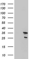 MORF4 Antibody - HEK293T cells were transfected with the pCMV6-ENTRY control (Left lane) or pCMV6-ENTRY MORF4 (Right lane) cDNA for 48 hrs and lysed. Equivalent amounts of cell lysates (5 ug per lane) were separated by SDS-PAGE and immunoblotted with anti-MORF4.