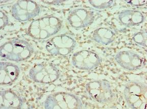 MORF4L1 / MRG15 Antibody - Immunohistochemistry of paraffin-embedded human rectum using antibody at 1:100 dilution.