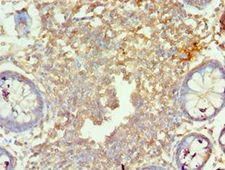 MORF4L1 / MRG15 Antibody - Immunohistochemistry of paraffin-embedded human rectum using antibody at 1:100 dilution.