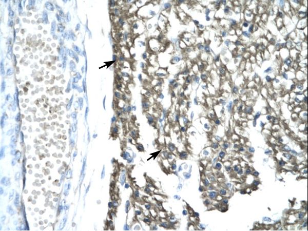 MORF4L1 / MRG15 Antibody - MORF4L1 / MRG15 antibody ARP32832_T100-MORF4L1 (mortality factor 4 like 1) Antibody was used in IHC to stain formalin-fixed, paraffin-embedded human heart.  This image was taken for the unconjugated form of this product. Other forms have not been tested.