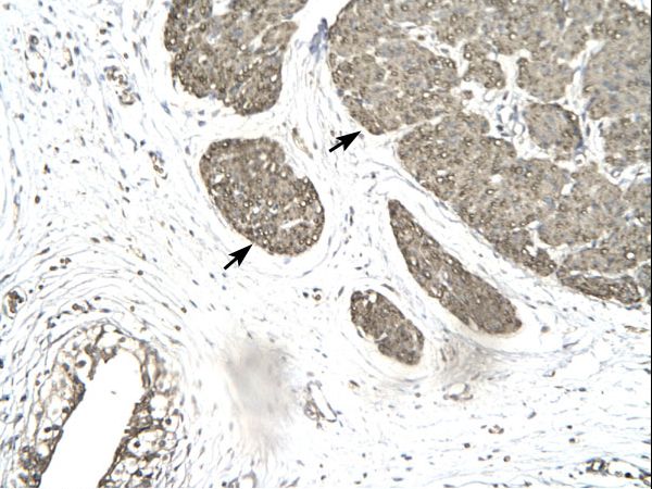 MORF4L1 / MRG15 Antibody - Human Urinary bladder.  This image was taken for the unconjugated form of this product. Other forms have not been tested.