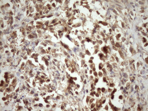MORF4L1 / MRG15 Antibody - Immunohistochemical staining of paraffin-embedded Human bladder tissue within the normal limits using anti-MORF4L1 mouse monoclonal antibody. (Heat-induced epitope retrieval by Tris-EDTA, pH8.0)(1:150)