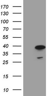 MORF4L1 / MRG15 Antibody - HEK293T cells were transfected with the pCMV6-ENTRY control (Left lane) or pCMV6-ENTRY MORF4L1 (Right lane) cDNA for 48 hrs and lysed. Equivalent amounts of cell lysates (5 ug per lane) were separated by SDS-PAGE and immunoblotted with anti-MORF4L1 (1:2000).