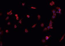 MORF4L1 / MRG15 Antibody - Staining K562 cells by IF/ICC. The samples were fixed with PFA and permeabilized in 0.1% Triton X-100, then blocked in 10% serum for 45 min at 25°C. The primary antibody was diluted at 1:200 and incubated with the sample for 1 hour at 37°C. An Alexa Fluor 594 conjugated goat anti-rabbit IgG (H+L) antibody, diluted at 1/600, was used as secondary antibody.