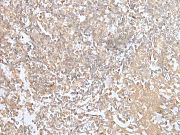 MORF4L1 / MRG15 Antibody - Immunohistochemistry of paraffin-embedded Human tonsil tissue  using MORF4L1 Polyclonal Antibody at dilution of 1:45(×200)