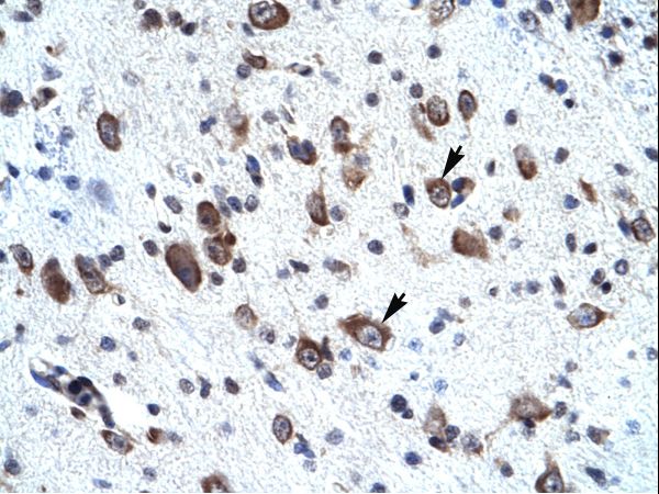 MORF4L2 / MRGX Antibody - MORF4L2 antibody ARP33721_T100-NP_036418-MORF4L2 (mortality factor 4 like 2) Antibody was used in IHC to stain formalin-fixed, paraffin-embedded human brain.  This image was taken for the unconjugated form of this product. Other forms have not been tested.
