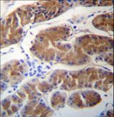MORN1 Antibody - MORN1 Antibody immunohistochemistry of formalin-fixed and paraffin-embedded human stomach tissue followed by peroxidase-conjugated secondary antibody and DAB staining.