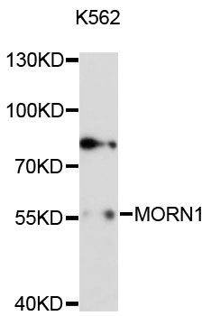 MORN1 Antibody - Western blot analysis of extracts of K-562 cells, using MORN1 antibody at 1:3000 dilution. The secondary antibody used was an HRP Goat Anti-Rabbit IgG (H+L) at 1:10000 dilution. Lysates were loaded 25ug per lane and 3% nonfat dry milk in TBST was used for blocking. An ECL Kit was used for detection and the exposure time was 90s.