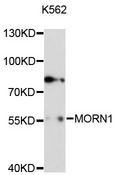 MORN1 Antibody - Western blot analysis of extracts of K-562 cells, using MORN1 antibody at 1:3000 dilution. The secondary antibody used was an HRP Goat Anti-Rabbit IgG (H+L) at 1:10000 dilution. Lysates were loaded 25ug per lane and 3% nonfat dry milk in TBST was used for blocking. An ECL Kit was used for detection and the exposure time was 90s.