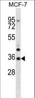MORN3 Antibody - MORN3 Antibody western blot of MCF-7 cell line lysates (35 ug/lane). The MORN3 antibody detected the MORN3 protein (arrow).