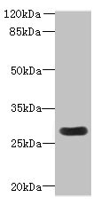 MORN3 Antibody - Western blot All lanes: MORN3 antibody at 2µg/ml + Mouse kidney tissue Secondary Goat polyclonal to rabbit IgG at 1/10000 dilution Predicted band size: 28, 19 kDa Observed band size: 28 kDa