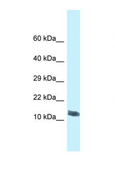 MORN4 Antibody - MORN4 antibody Western blot of Mouse Spleen lysate. Antibody concentration 1 ug/ml.  This image was taken for the unconjugated form of this product. Other forms have not been tested.