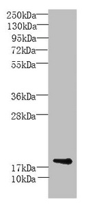 MORN5 Antibody - Western Blot All lanes: MORN5 antibody at 4µg/ml + Mouse brain tissue Secondary Goat polyclonal to rabbit IgG at 1/10000 dilution Predicted band size: 19, 21 kDa Observed band size: 19 kDa