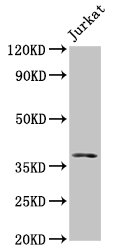 MOS Antibody - Positive Western Blot detected in Jurkat whole cell lysate. All lanes: MOS antibody at 5 µg/ml Secondary Goat polyclonal to rabbit IgG at 1/50000 dilution. Predicted band size: 38 KDa. Observed band size: 38 KDa