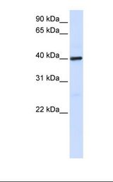 MOSC1 Antibody - Placenta lysate. Antibody concentration: 1.0 ug/ml. Gel concentration: 12%.  This image was taken for the unconjugated form of this product. Other forms have not been tested.