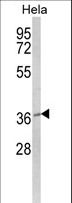 MOSC2 Antibody - Western blot of MOSC2 Antibody in HeLa cell line lysates (35 ug/lane). MOSC2 (arrow) was detected using the purified antibody.